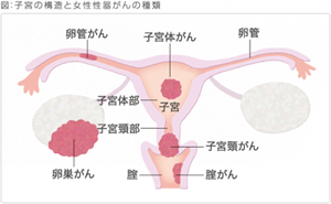 子宮がん